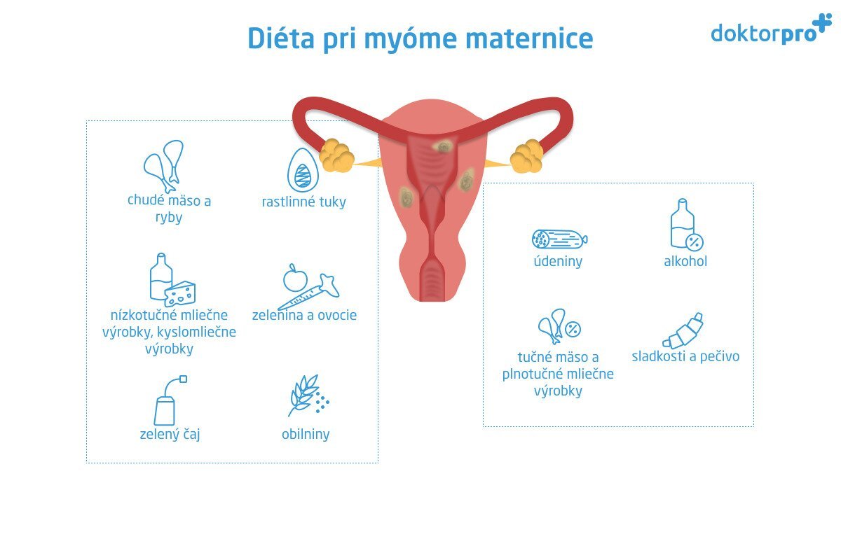 Diéta pri myóme maternice