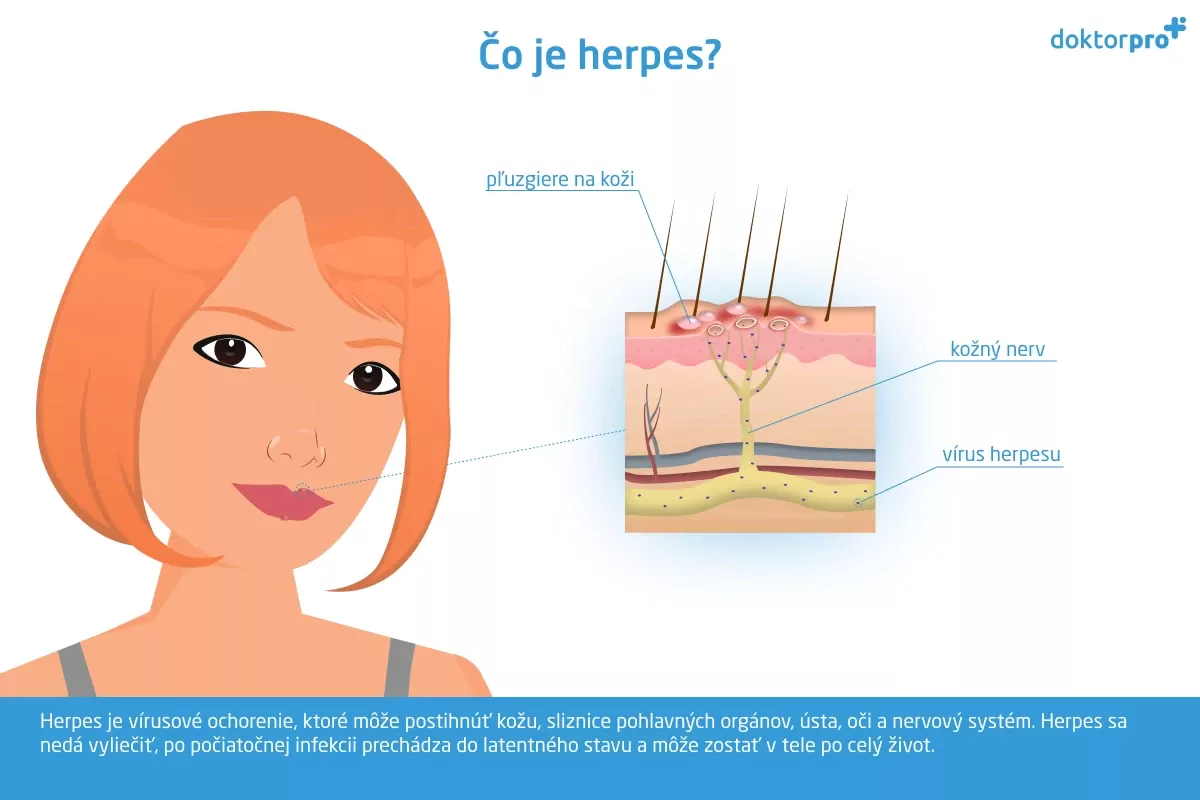 Čo je herpes?