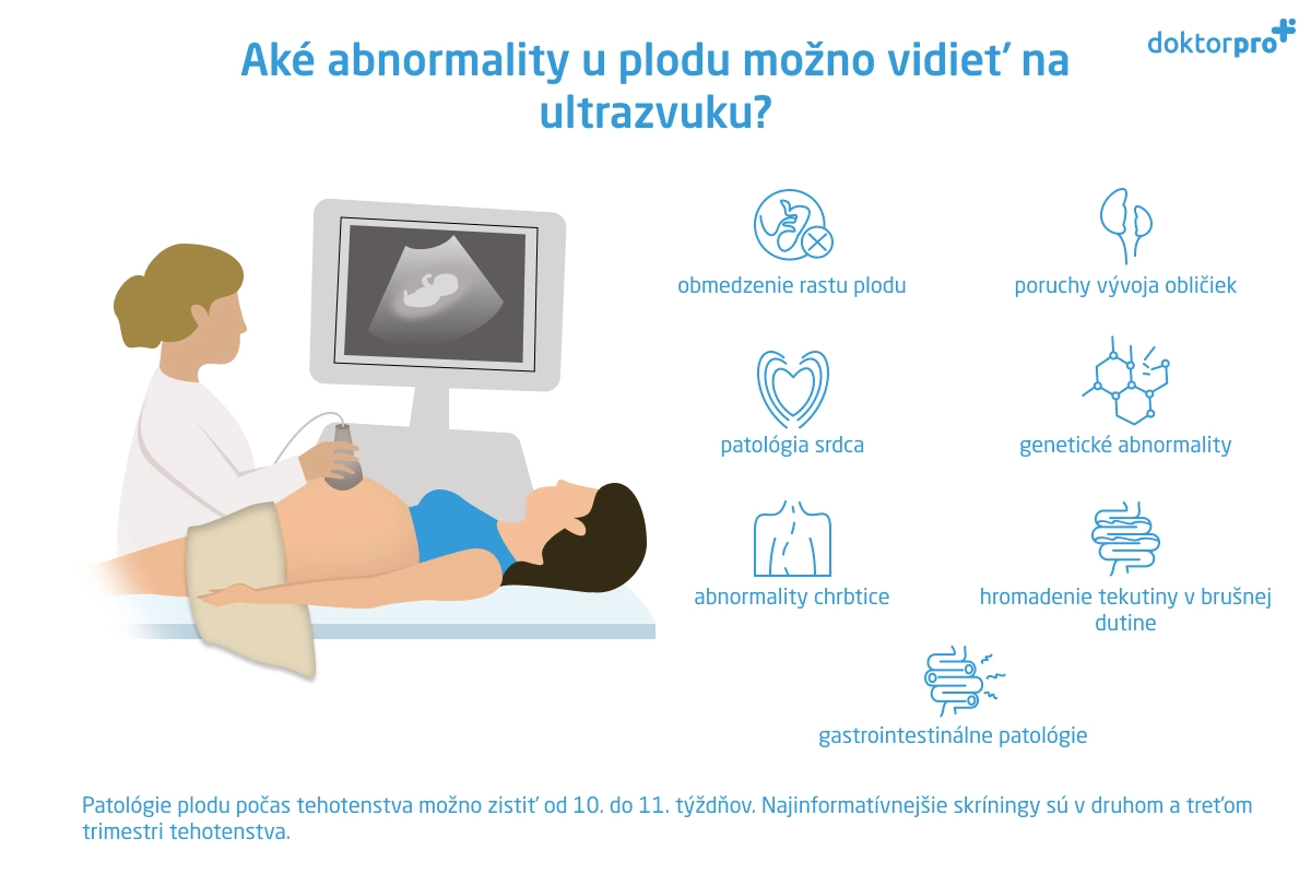 Aké abnormality u plodu možno vidieť na ultrazvuku?